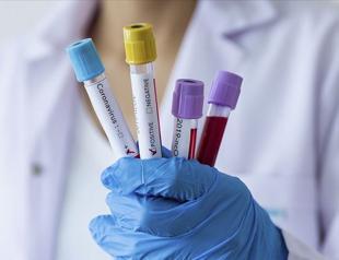 WHO hopes pandemic over in two years as Europe battles rising cases