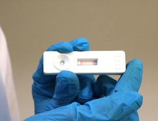 Turkish university develops 8-minute virus test kit