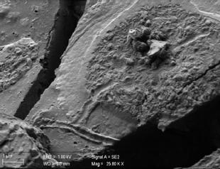 Study finds preserved brain material in Vesuvius victim