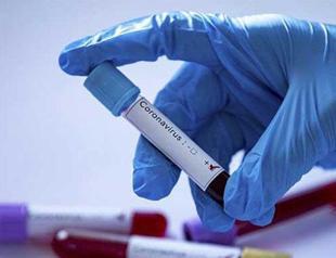 Severe virus cases continue to rise, warns Turkey’s health minister