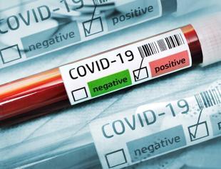 29 virus cases at minor league football club