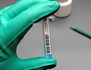 G-20 summit ends with support for COVID-19 vaccines for all