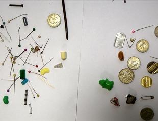 Turkish doctor reveals bizarre collection of accidentally swallowed items by people