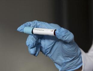 Experts urge caution, vigilance over virus variants