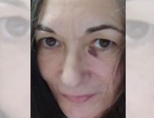 Judge seeks answers for jail’s Ghislaine Maxwell treatment