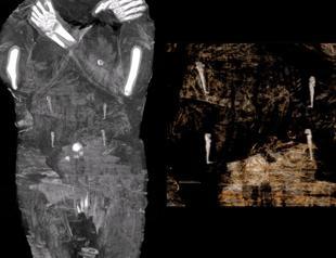 Egyptian mummy was a pregnant woman, not a male priest