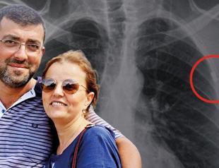 Veteran engineer living with bullet in his chest since July 15