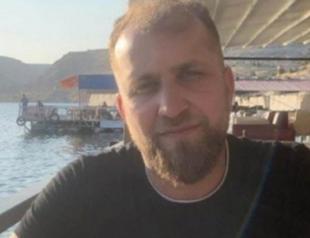 Man dies suspiciously during hair transplant