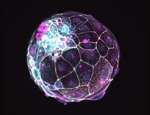 Scientists use stem cells to create models of pre-embryos