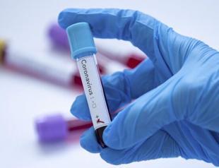 Two years since first COVID case reported in Turkey