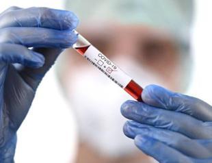 Weekly virus cases down in big cities