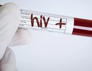 Aesthetician asks compensation for wrong HIV positive tests