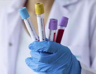 Turkey in last days of pandemic, says minister