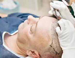 400,000 Europeans visit Turkey for health tourism