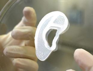 Surgeons transplant 3D ear made of living cells
