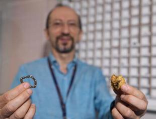 Objects swallowed by children on display at Antalya hospital