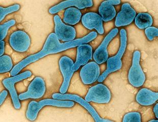 Ghana reports first cases of deadly Marburg virus