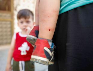 Expert warns of Zika risk in Istanbul