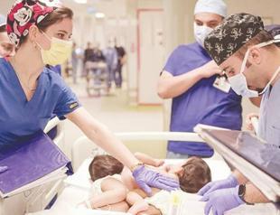 Turkish surgeons separate Siamese twins using new technique