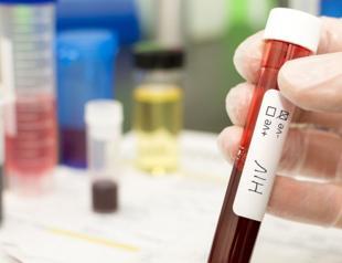 Third person cured of HIV after stem cell transplant