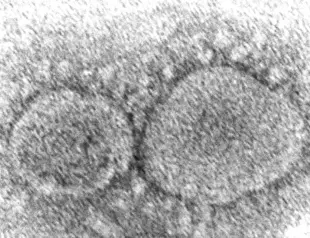 FBI director says Covid most likely caused by Wuhan lab accident