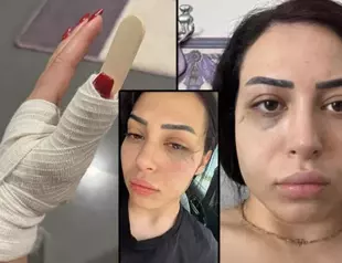 Two held over attack on Turkish Cypriot woman