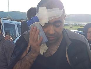 Journalist beaten in eastern city, two arrested