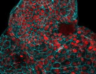 Cells from pregnancy used to grow mini organs