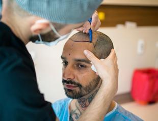 Health tourism revenues reach $2.3 billion last year