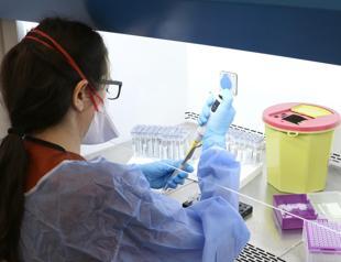 Study involving Turkish scientist finds solution to Alzheimers