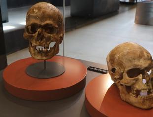 Scars on 5,000-year-old skull showcase ancient technique in Samsun Museum