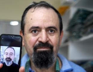 Smart drug turns cancer patient’s white hair black