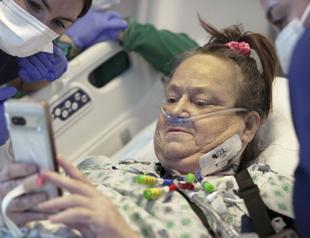 Woman back on dialysis after pig kidney removed