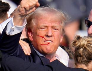 Im supposed to be dead Trump tells NYP after assassination attempt