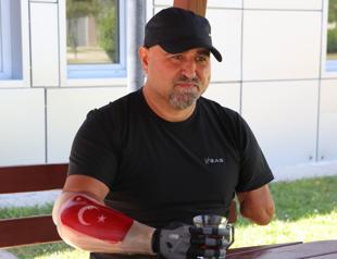 Veteran becomes first with bionic hand in country