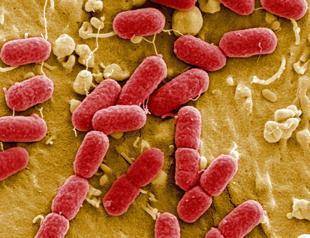 Drug-resistant superbugs projected to kill 39 million by 2050