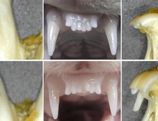 Japanese researchers test pioneering drug to regrow teeth