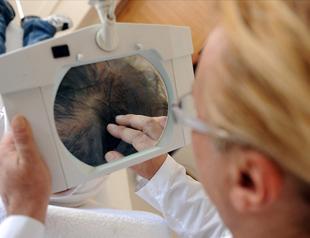 Istanbul hair transplant boom shifts focus to more European clients