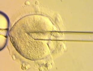 IVF trial reduces risk of babies inheriting diseases