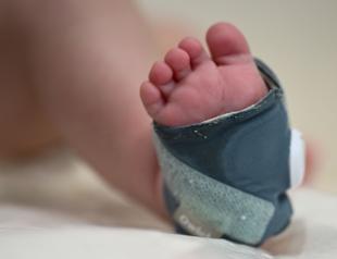 ‘Smart sock’ monitors baby with heart failure diagnosis