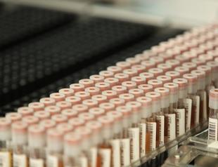 Turkish Red Crescent boosts hope for stem cell patients