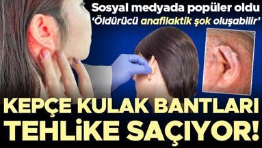 Sosyal medyada popüler oldu: Kepçe kulak bantları tehlike saçıyor ‘Öldürücü anafilaktik şok oluşabilir’