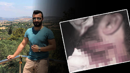 Doktoru boğazından jiletle yaralamıştı 18 yıl hapis cezasına çarptırıldı