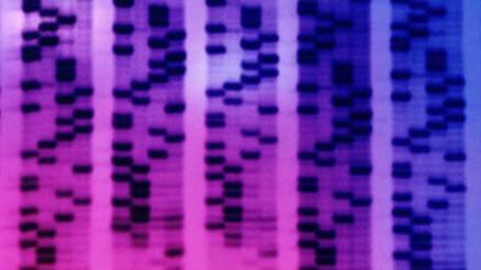 Prostat kanserini erken teşhis edebilen tükürük testi