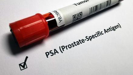 Narin Güran davasında bahsi geçen PSA nedir, ne demek, ne anlama geliyor