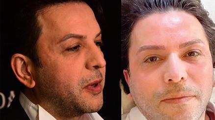 Ayrılık sürecinde döküldü...Sadece kaş yaptırdım