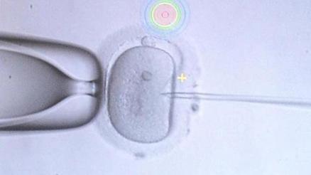 Prof. Dr. Kaan Aydos » SPERM SAYISI NASIL YORUMLANMALI Prof. Dr. Kaan Aydos » SPERM SAYISI NASIL YORUMLANMALI