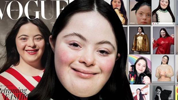 Doktorlar 'asla yürüyemez ve konuşamaz' dedi, hemşire hastanede terk etmelerini önerdi! Herkese meydan okuyup 21 yaşında Vogue dergisine kapak oldu