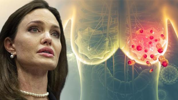 Angelina Jolie ile bilinirliği artmıştı: Kanser döngüsünü ‘dokuları aldırarak’ kırmak mümkün mü?