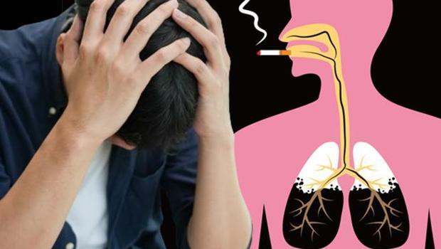 Doktorları bile şaşırttı: Sigara boğazında kıllanma yaptı! 14 yıl boyunca devam etti...  ‘Kıllı dil sorunuyla başvuran hastalar da var’